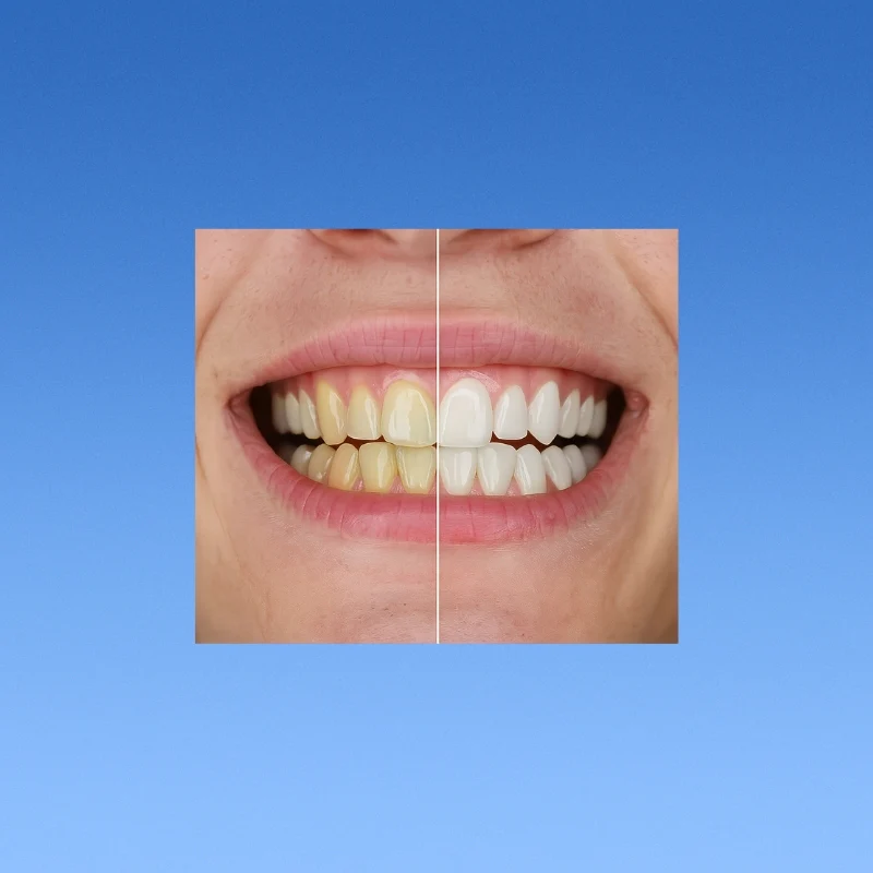 Teeth Whitening Gold Serum Pen - Image 6