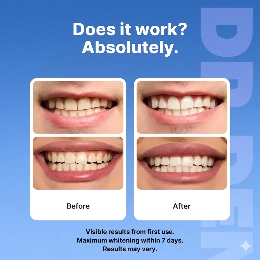 Dr Dent Whitening Strips - Image 3
